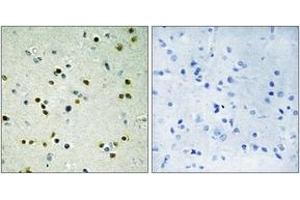 Immunohistochemistry analysis of paraffin-embedded human brain, using JHD3B Antibody. (JHD3B 抗体  (AA 351-400))