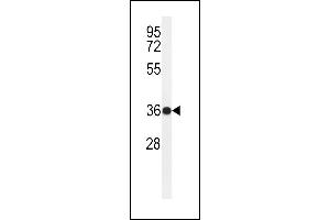 Western blot analysis of R6G Antibody (N-term) (ABIN650946 and ABIN2840004) in ZR-75-1 cell line lysates (35 μg/lane). (PARD6G 抗体  (N-Term))