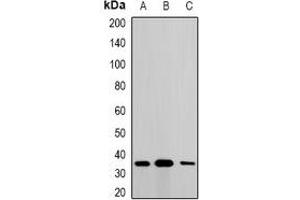 Western blot analysis of Metaxin-1 expression in A549 (A), SKOV3 (B), mouse liver (C) whole cell lysates. (Metaxin 1 抗体)