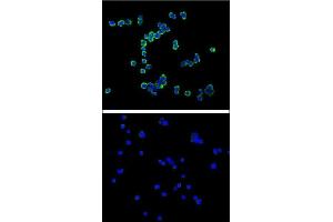 Confocal immunofluorescent analysis of C antibody  with R cell (above) compared with Jurkat as negative cell line (below). (Syndecan 1 抗体)