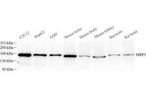 Western blot analysis of MRP3 (ABIN7073148) at dilution of 1: 500 (ABCC3 抗体)