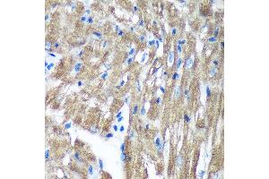 Immunohistochemistry of paraffin-embedded Mouse heart using TIMMDC1 Rabbit pAb (ABIN7270929) at dilution of 1:100 (40x lens). (TIMMDC1 抗体  (AA 206-285))