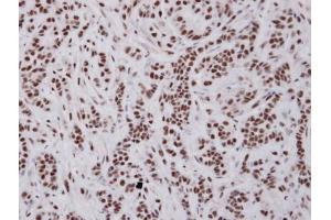 IHC-P Image Immunohistochemical analysis of paraffin-embedded A549 xenograft , using UAP56, antibody at 1:100 dilution. (DDX39B 抗体)