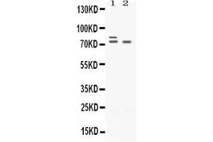 Western blot analysis of Plzf expression in rat ovary extract ( Lane 1) and SKOV3 whole cell lysates ( Lane 2). (ZBTB16 抗体  (AA 1-165))