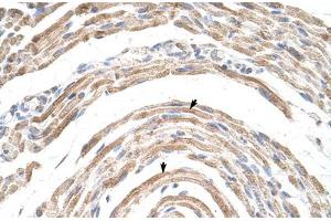 Immunohistochemical staining (Formalin-fixed paraffin-embedded sections) of human muscle with CPSF6 polyclonal antibody .