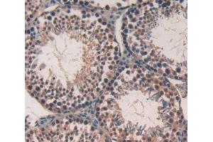 Used in DAB staining on fromalin fixed paraffin- embedded Kidney tissue (CABIN1 抗体  (AA 11-289))