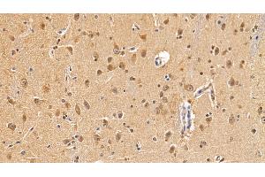 Detection of MAP1LC3a in Human Cerebrum Tissue using Polyclonal Antibody to Microtubule Associated Protein 1 Light Chain 3 Alpha (MAP1LC3a) (MAP1LC3A 抗体  (AA 1-120))