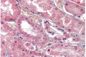 Kidney, Human: Formalin-Fixed, Paraffin-Embedded (FFPE) (PKD1 抗体  (AA 4289-4300))