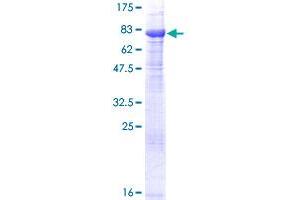 FANCC Protein (AA 1-558) (GST tag)