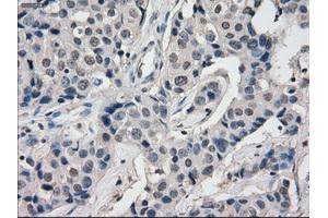 Image no. 3 for anti-Budding Uninhibited By Benzimidazoles 1 Homolog beta (Yeast) (BUB1B) antibody (ABIN1496995) (BUB1B 抗体)