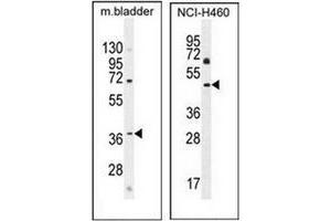 Western blot analysis in mouse bladder tissue (left) and NCI-H460 cell line (right) lysates  (35ug/lane) using CL029 antibody (N-term) Cat. (C12ORF29 抗体  (N-Term))