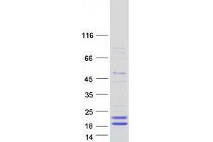Western Blotting (WB) image for Phospholipase A2, Group X (PLA2G10) protein (Myc-DYKDDDDK Tag) (ABIN2729070)