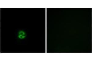 Immunofluorescence analysis of A549 cells, using CHST6 Antibody.