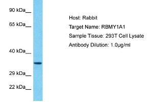 Host: Rabbit Target Name: RBMY1A1 Sample Tissue: Human 293T Whole Cell Antibody Dilution: 1ug/ml (RBMY1A1 抗体  (C-Term))