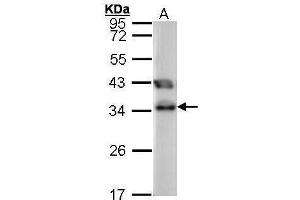 WB Image Sample (30 ug of whole cell lysate) A: 293T 12% SDS PAGE antibody diluted at 1:1000 (TTC1 抗体)