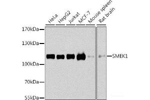 Western blot analysis of extracts of various cell lines using SMEK1 Polyclonal Antibody at dilution of 1:1000. (SMEK1 抗体)