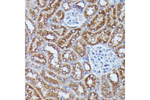 Immunohistochemistry of paraffin-embedded mouse kidney using DDX6 antibody (ABIN7266704) at dilution of 1:100 (40x lens).