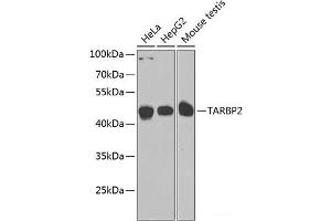 Western blot analysis of extracts of various cell lines using TARBP2 Polyclonal Antibody at dilution of 1:1000. (TARBP2 抗体)