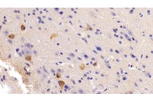 Detection of NOS1 in Mouse Cerebrum Tissue using Polyclonal Antibody to Nitric Oxide Synthase 1, Neuronal (NOS1) (NOS1 抗体  (AA 53-247))