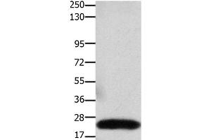 Western Blot analysis of Human colon cancer tissue using Claudin 3 Polyclonal Antibody at dilution of 1:550 (Claudin 3 抗体)
