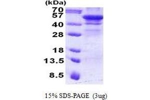 Image no. 1 for Hexosaminidase A (HEXA) protein (His tag) (ABIN1098761) (Hexosaminidase A Protein (HEXA) (His tag))