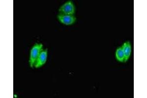 Immunofluorescent analysis of HepG2 cells using ABIN7169234 at dilution of 1:100 and Alexa Fluor 488-congugated AffiniPure Goat Anti-Rabbit IgG(H+L) (WNK4 抗体  (AA 828-1106))