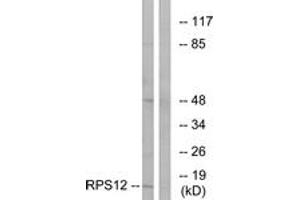 Western blot analysis of extracts from COLO cells, using RPS12 Antibody. (RPS12 抗体  (AA 83-132))
