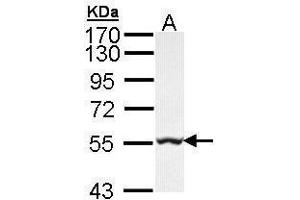 WB Image Sample (30 ug of whole cell lysate) A: Hep G2 , 7. (GLYCTK 抗体)