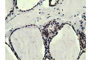 Immunohistochemical staining of paraffin-embedded Human liver tissue using anti-L1CAM mouse monoclonal antibody. (L1CAM 抗体)