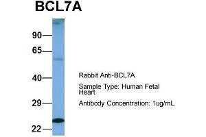 Host: Rabbit  Target Name: BCL7A  Sample Tissue: Human Fetal Heart  Antibody Dilution: 1. (BCL7A 抗体  (Middle Region))