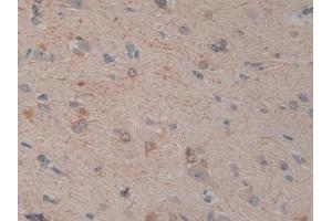 Immunohistochemistry (IHC) image for anti-Interleukin 12 alpha (IL12A) (AA 23-219) antibody (ABIN7428245)