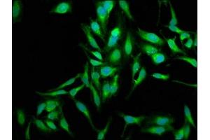 Immunofluorescence staining of Hela cells with ABIN7170983 at 1:250, counter-stained with DAPI. (SOD2 抗体  (AA 64-175))