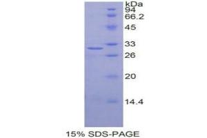 SDS-PAGE analysis of Human IGF2BP2 Protein. (IGF2BP2 蛋白)
