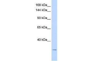 KCNK6 antibody used at 1 ug/ml to detect target protein. (KCNK6 抗体  (N-Term))