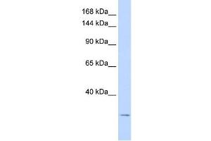 KCNK6 antibody used at 1 ug/ml to detect target protein.