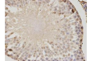 Immunohistochemistry (IHC) image for anti-Proteasome (Prosome, Macropain) Activator Subunit 1 (PA28 Alpha) (PSME1) antibody (ABIN1876546) (PSME1 抗体)