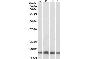 Western Blotting (WB) image for anti-Ubiquitin-Conjugating Enzyme E2L 3 (UBE2L3) antibody (ABIN5894613) (UBE2L3 抗体)