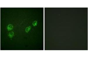 Immunofluorescence analysis of HuvEc cells, using PLB (Phospho-Ser16+Thr17) Antibody. (Phospholamban 抗体  (pSer16))