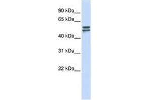 Image no. 1 for anti-Glucose-6-Phosphate Dehydrogenase (G6PD) (AA 180-229) antibody (ABIN6744275)