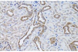 Immunohistochemistry of paraffin-embedded Rat kidney using ITGAV Polyclonal Antibody at dilution of 1:50 (40x lens). (CD51 抗体)