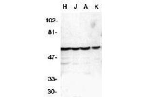 Western blot analysis of caspase-10 in HeLa (H), Jurkat (J), A431 (A), K562 (K) whole cell lysates with AP30189PU-N Caspase-10 antibody at 1 μg/ml. (Caspase 10 抗体  (C-Term))