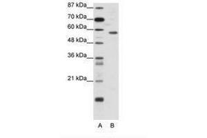 Image no. 1 for anti-YY1 Transcription Factor (YY1) (N-Term) antibody (ABIN6736135) (YY1 抗体  (N-Term))