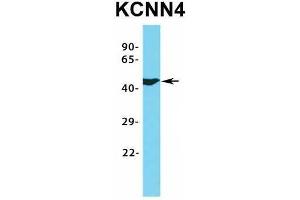 Western Blotting (WB) image for anti-Potassium Intermediate/small Conductance Calcium-Activated Channel, Subfamily N, Member 4 (KCNN4) (C-Term) antibody (ABIN2776147)