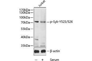 Western blot analysis of extracts of Jurkat cells, using Phospho-Syk-Y525/526 antibody (ABIN6135327, ABIN6136270, ABIN6136271 and ABIN6225570) at 1:1000 dilution. (SYK 抗体  (pTyr525, pTyr526))