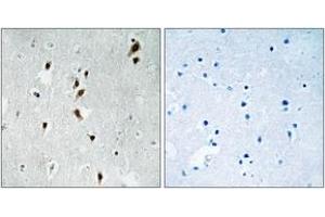 Immunohistochemistry (IHC) image for anti-MAP Kinase Interacting serine/threonine Kinase 1 (MKNK1) (AA 351-400), (pThr385) antibody (ABIN1532155)