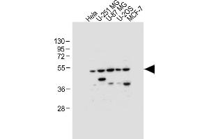 All lanes : Anti-DFNA5 Antibody (N-term) at 1:1000 dilution Lane 1: Hela whole cell lysate Lane 2: U-251 MG whole cell lysate Lane 3: U-87 MG whole cell lysate Lane 4: U-2OS whole cell lysate Lane 5: MCF-7 whole cell lysate Lysates/proteins at 20 μg per lane. (DFNA5 抗体  (N-Term))