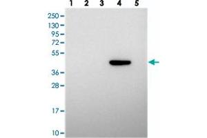 Western blot analysis of Lane 1: RT-4, Lane 2: U-251 MG, Lane 3: Human Plasma, Lane 4: Liver, Lane 5: Tonsil with PRDM12 polyclonal antibody  at 1:250-1:500 dilution. (PRDM12 抗体)