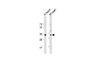 All lanes : Anti-Mouse Nkx2-5 Antibody (Center) at 1:2000 dilution Lane 1: human heart lysate Lane 2: mouse heart lysate Lysates/proteins at 20 μg per lane. (NK2 Homeobox 5 抗体  (AA 192-225))