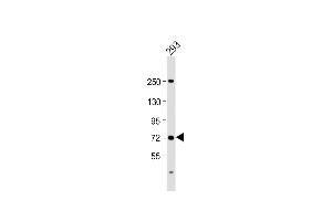 Western Blotting (WB) image for anti-Solute Carrier Family 6 (Neutral Amino Acid Transporter), Member 19 (SLC6A19) (AA 544-575) antibody (ABIN6244128)