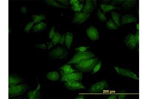 Immunofluorescence of monoclonal antibody to RGL2 on HeLa cell. (RGL2 抗体  (AA 644-743))